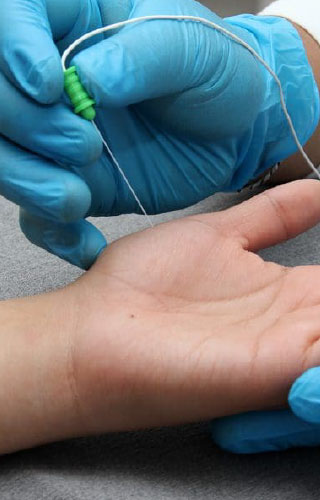 2-Electrodiagnostico---Electromiografía